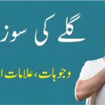 گلے کی سوزش کی علامات، اسباب اور علاج سے متعلق مکمل رہنمائی، جس میں گھریلو، یونانی اور جدید طریقہ علاج شامل ہیں۔