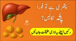 پتے کی پتھری کی علامات، وجوہات اور ہربل علاج — قدرتی طریقے سے پتھری کا مؤثر علاج، بغیر آپریشن